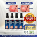 Combo 4 En 1 Suero Anti Hongos
