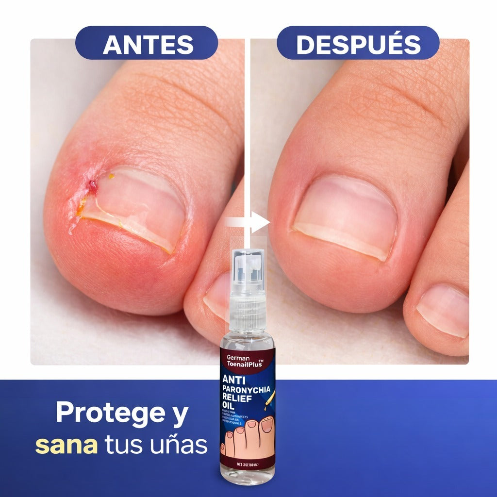 Combo 4 En 1 Suero Anti Hongos